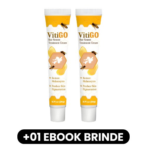 VitiGO - Creme de Tratamento para Vitiligo - Mania das CoisasVitiGO - Creme de Tratamento para VitiligoMania das Coisas