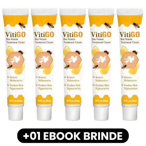 VitiGO - Creme de Tratamento para Vitiligo - Mania das CoisasVitiGO - Creme de Tratamento para VitiligoMania das Coisas