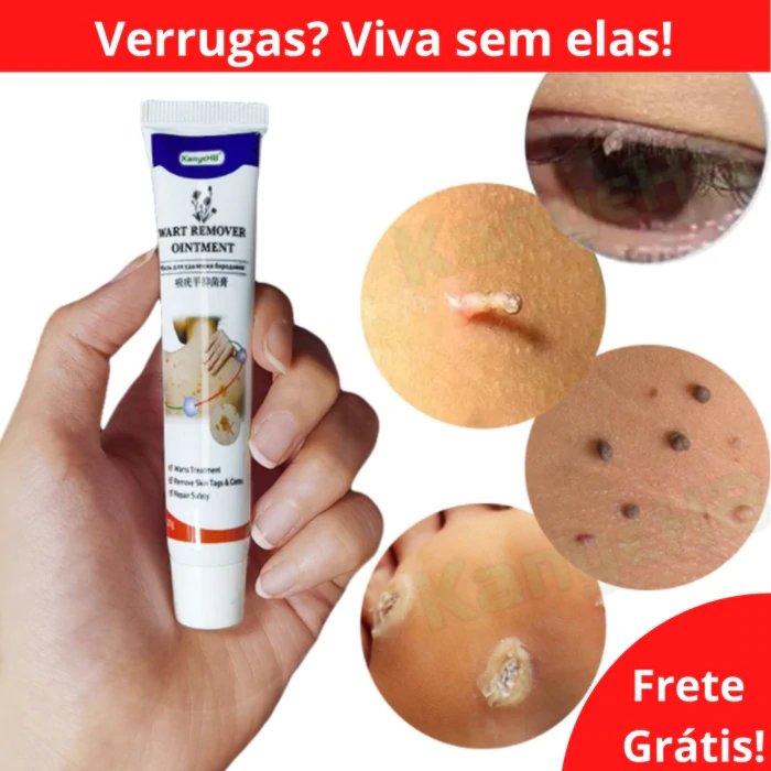 SomeVerrugas! - Creme de tratamento de verrugas + EBOOK GRÁTIS - Mania das CoisasSomeVerrugas! - Creme de tratamento de verrugas + EBOOK GRÁTISMania das Coisas